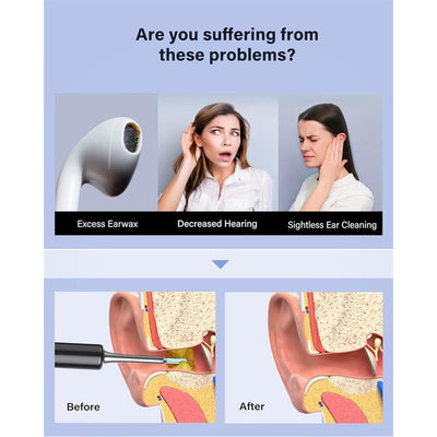 Bebird T5 3mp Kamera 3.5mm Lens Sarjli Wifi Goruntulu Kulak Temizleyici Siyah Renk