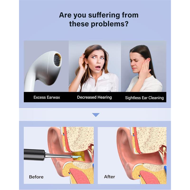 Bebird T5 3mp Kamera 3.5mm Lens Sarjli Wifi Goruntulu Kulak Temizleyici Siyah Renk