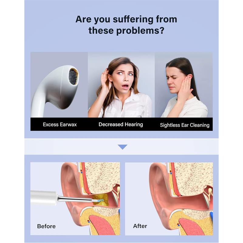 Bebird T5 3mp Kamera 3.5mm Lens Sarjli Wifi Goruntulu Kulak Temizleyici Beyaz Renk