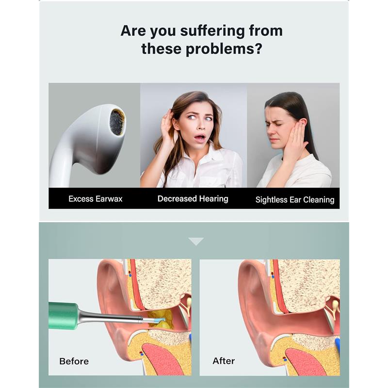 Bebird T5 3mp Kamera 3.5mm Lens Sarjli Wifi Goruntulu Kulak Temizleyici Yesil Renk